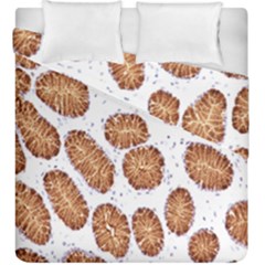 Formalin Paraffin Human Stomach Stained Bacteria Brown Duvet Cover Double Side (king Size) by Mariart
