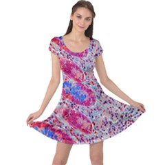 Histology Inc Histo Logistics Incorporated Alcian Blue Cap Sleeve Dress by Mariart